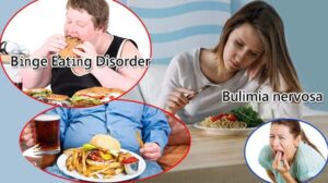 اختلال خوردن مرکز مشاوره رهنمون آمل ، مرکز مشاوره مازندران ، بهترین روانشناس آمل ، بهترین مشاور آمل و نور و محمود آباد